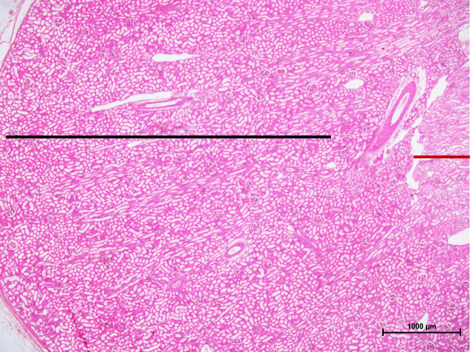 Bronchus